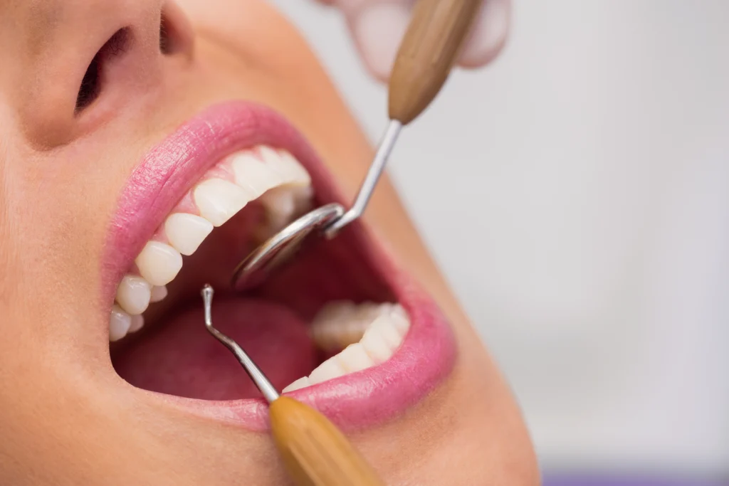 smile designing